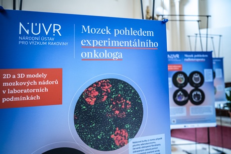 Výstava Mozek pohledem biomedicíny Výstava Mozek pohledem biomedicíny