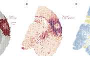 Prostorová transkriptomika odhaluje organizaci tkáně po cévní mozkové příhodě. A) Prostorově definované oblasti s jedinečným buněčným složením a reakcí na poškození. B) Lokalizace genové exprese poskytující vhled do molekulárních aktivit v různých oblastech. C) Lokalizace biologických procesů ilustrující zapojení rozličných molekulárních a buněčných drah v reakci na poškození.