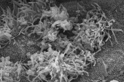 Bakterie B. pertussis navázaná na lidské řasinkové buňky dýchací sliznice zobrazená elektronovým mikroskopem. 