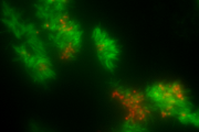 Bakterie B. pertussis navázaná na lidské řasinkové buňky dýchací sliznice zobrazená  fluorescenčním mikroskopem. 