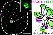Snímek z 3D-SIM mikroskopie o vysokém rozlišení. Pohled na buněčné jádro (ohraničené čárkovaně) vystavené působení ionizujícího záření. RAD18 je v místě DNA poškození (fialově), zatímco 53BP1 je vytlačen na okraj (zeleně).
