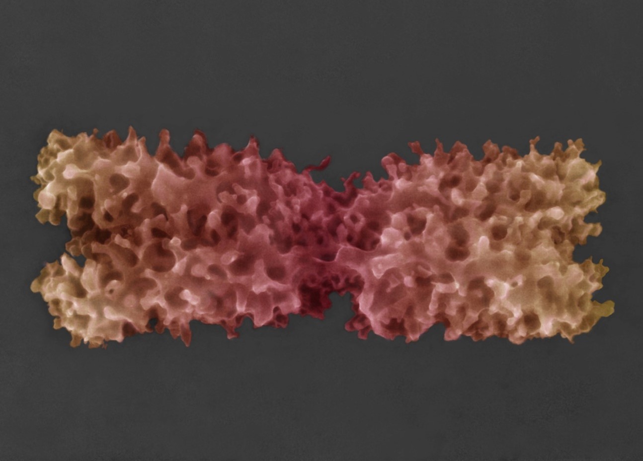 Kolorovaný snímek chromozomu v nativním stavu získané pomocí nově vyvinuté pokročilé environmentální rastrovací elektronová mikroskopie