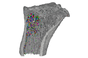 Zobrazení tukových  buněk – adipocytů – ve struktuře kosti. Barevně označené kuličky reprezentují jednotlivé tukové buňky.